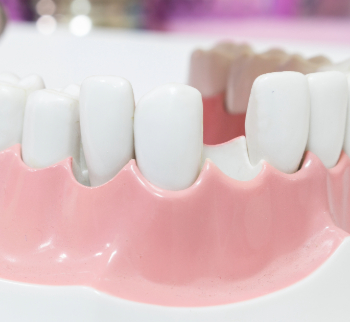 Periodontics